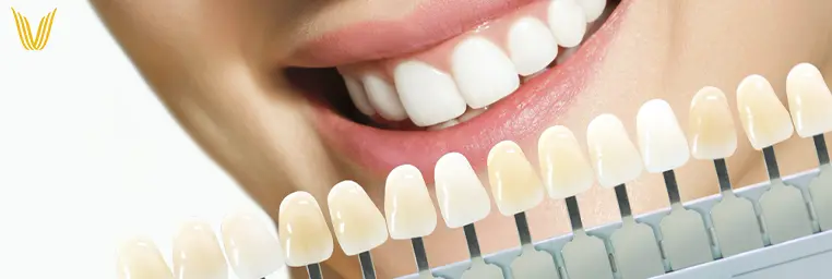blanqueamiento dental concepcion
