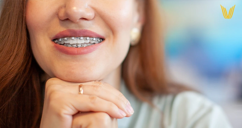 ortodoncia concepcion